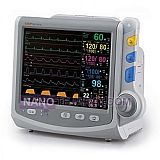 مانیتورینگ ICU مانیتورینگ ICU